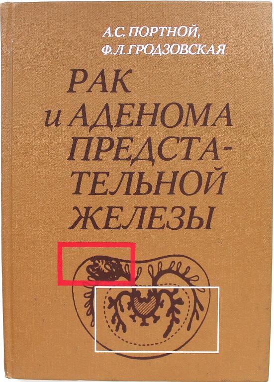 А. Портной, Ф. Гродзовская «РАК И АДЕНОМА ПРЕДСТАТЕЛЬНОЙ ЖЕЛЕЗЫ» (Медицина, 1984)