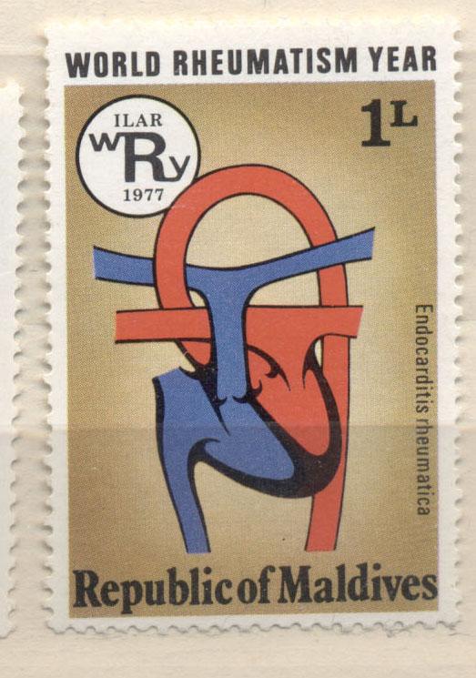 Мальдивы 1977 г. Борьба с ревматизмом негашеная* *