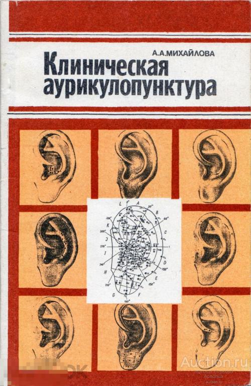 Клиническая аурикулопунктура. А. А. Михайлова. 1992 акупунктура иглотерапия иглоукалывание 