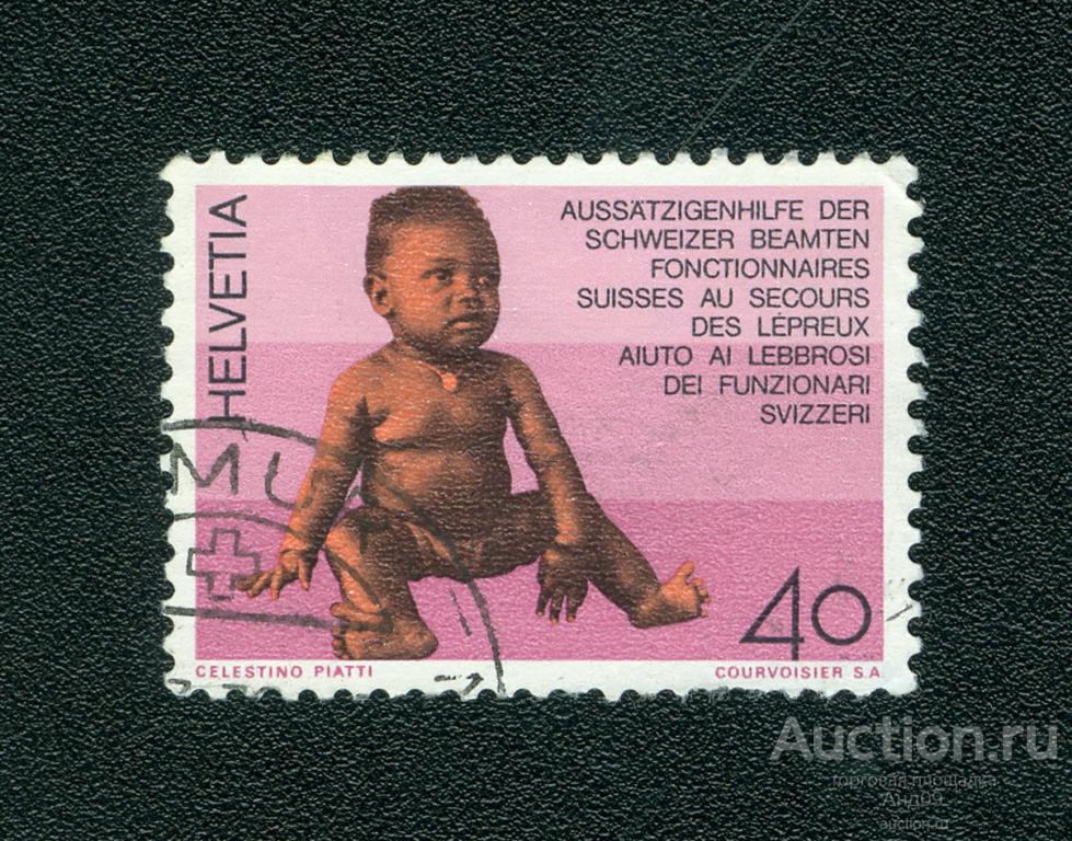 1976 г. Швейцария - Больной ребенок (0530f)