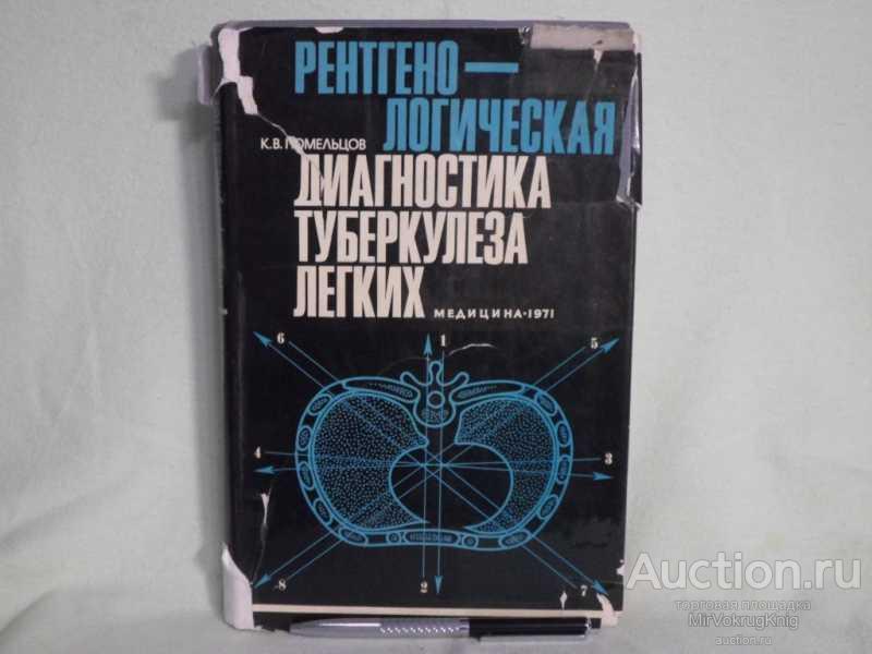 #1562422 Помельцов К. В. Рентгенологическая диагностика туберкулеза легких