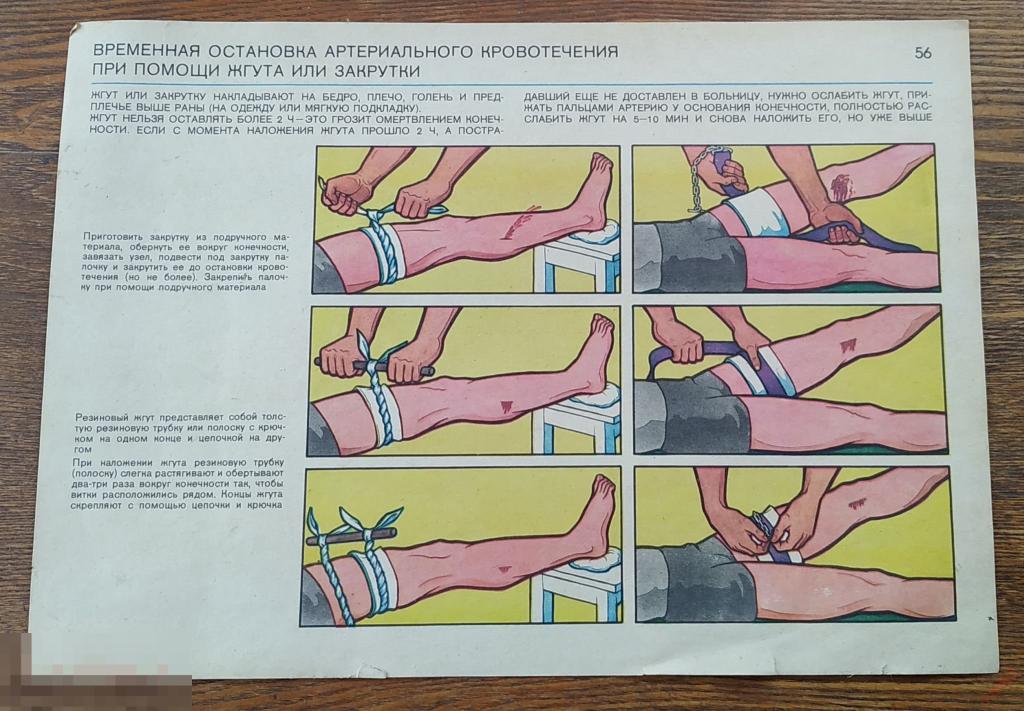 Плакат наглядное пособие Временная остановка артериального кровотечения. БГСО * 