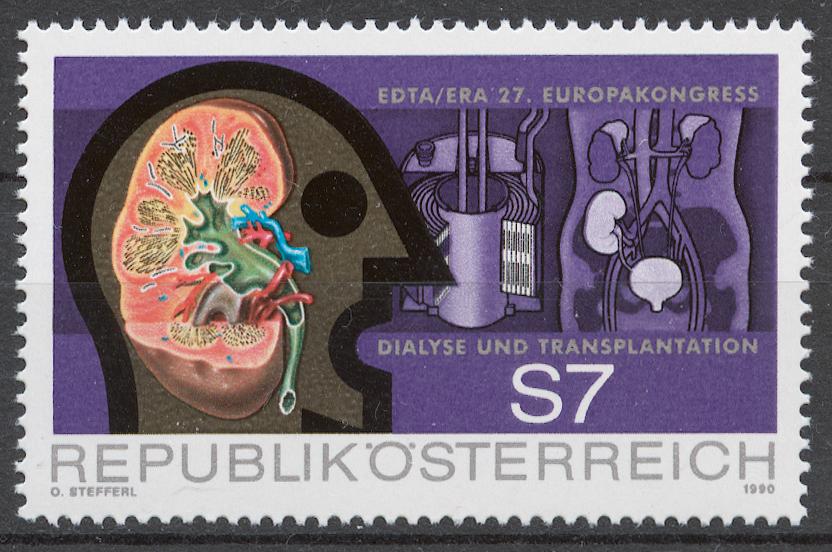 Австрия 1990 Mi# 2002** МЕДИЦИНСКИЙ КОНГРЕСС ПО ДИАЛИЗУ И ТРАНСПЛАНТАЦИИ