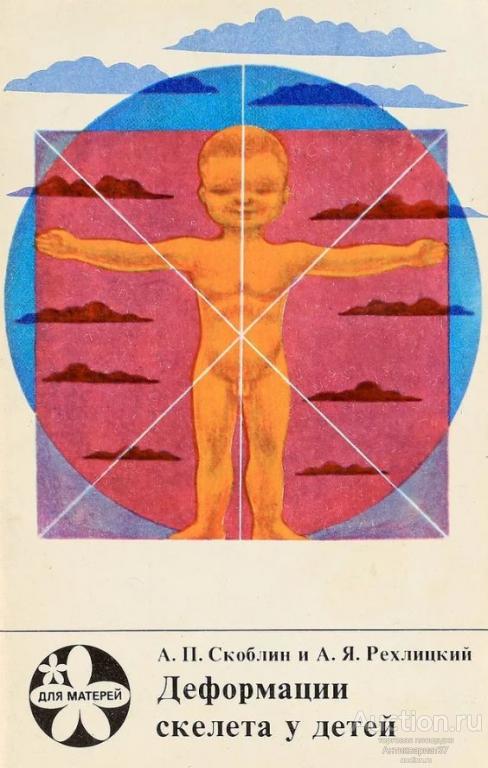 Книга Деформации скелета у детей / Скоблин, Рехлицкий, 1975 г.