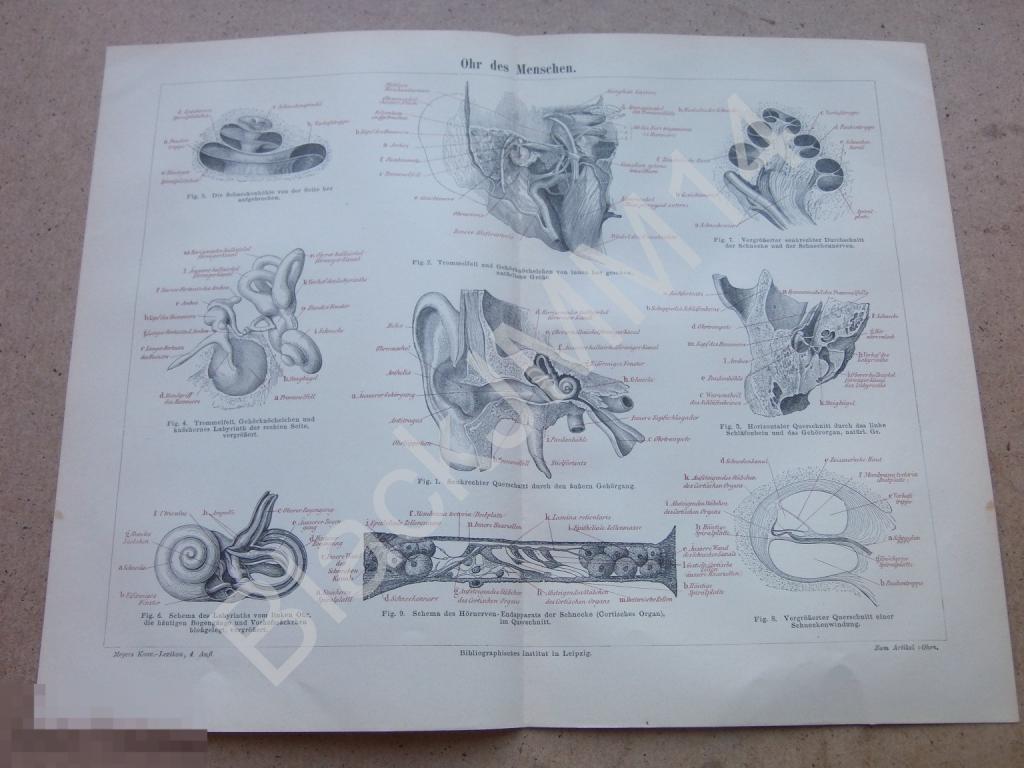 1890 г. Литография  Ухо человека Улитка Барабанная перепонка