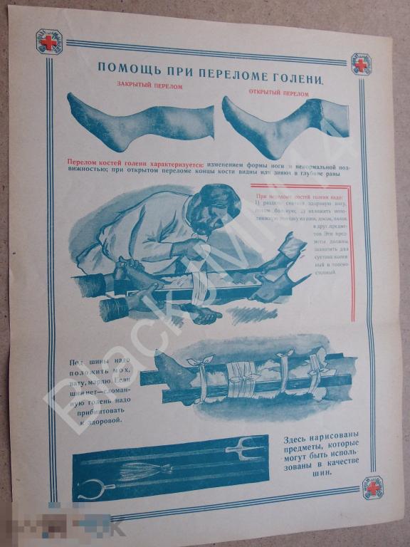 1928 Плакат Таблица Красный Крест Помощь при переломе голени