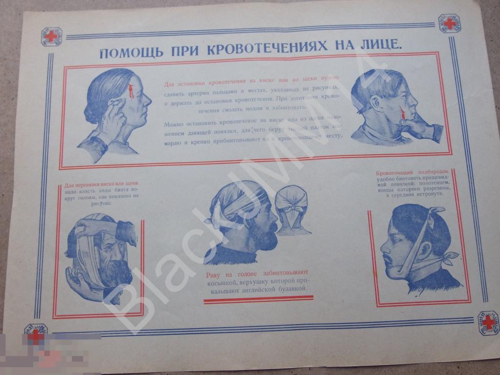 1928 Плакат Таблица Красный Крест Помощь при кровотечениях на лице