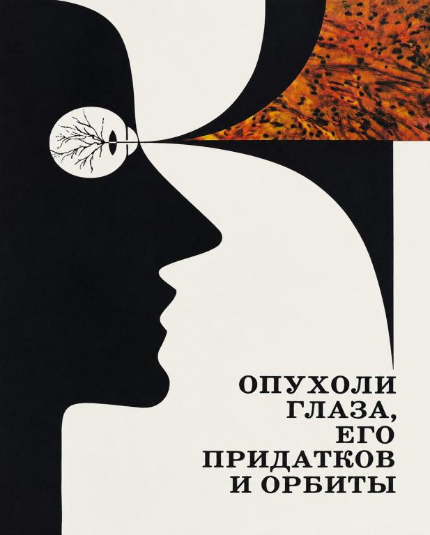 Бархиш Опухоли глаза, его придатков и орбиты 1978 231